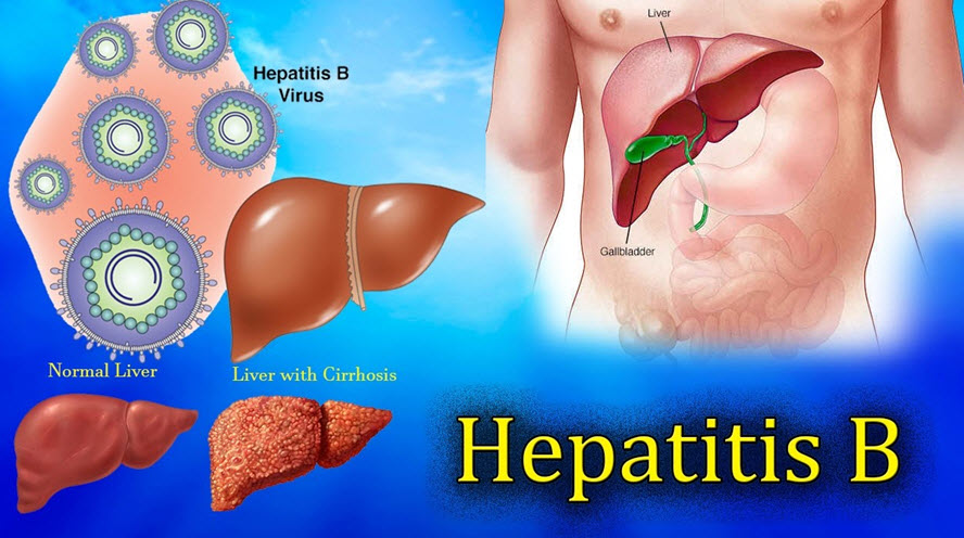 تماس با خون و ترشحات جنسی آلوده نتیجه ابتلا به هپاتیت  B